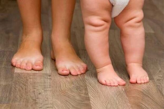 Valgus deformacija