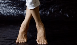 Valgus deformacija