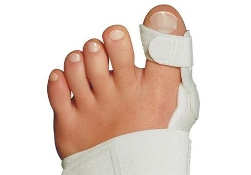 Valgus deformacija